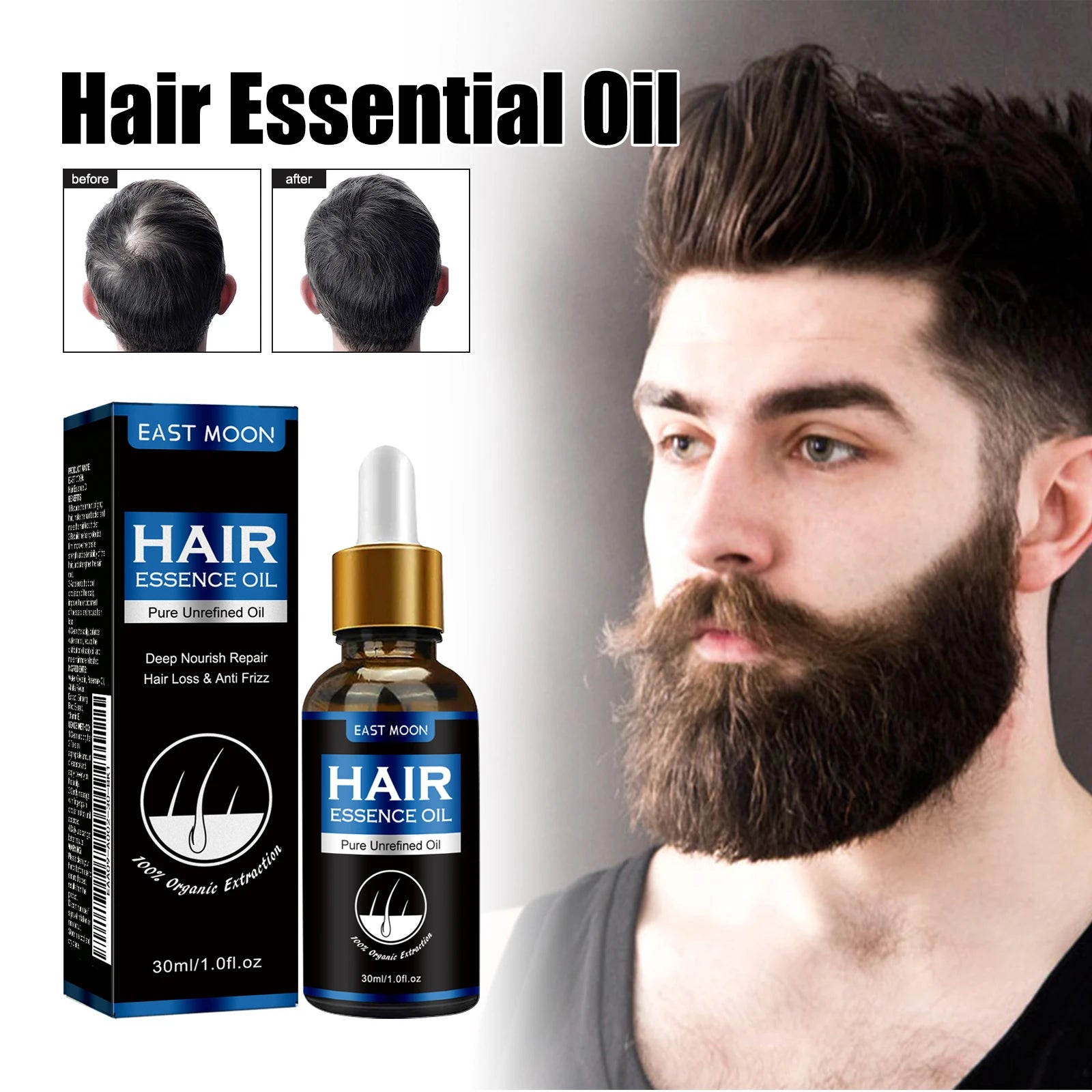 East Moon Men's Hair Growth Essence 30ml — Strengthen, Nourish & Prevent Hair Loss
