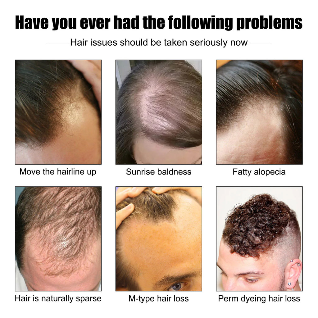East Moon Men's Hair Growth Essence 30ml — Strengthen, Nourish & Prevent Hair Loss