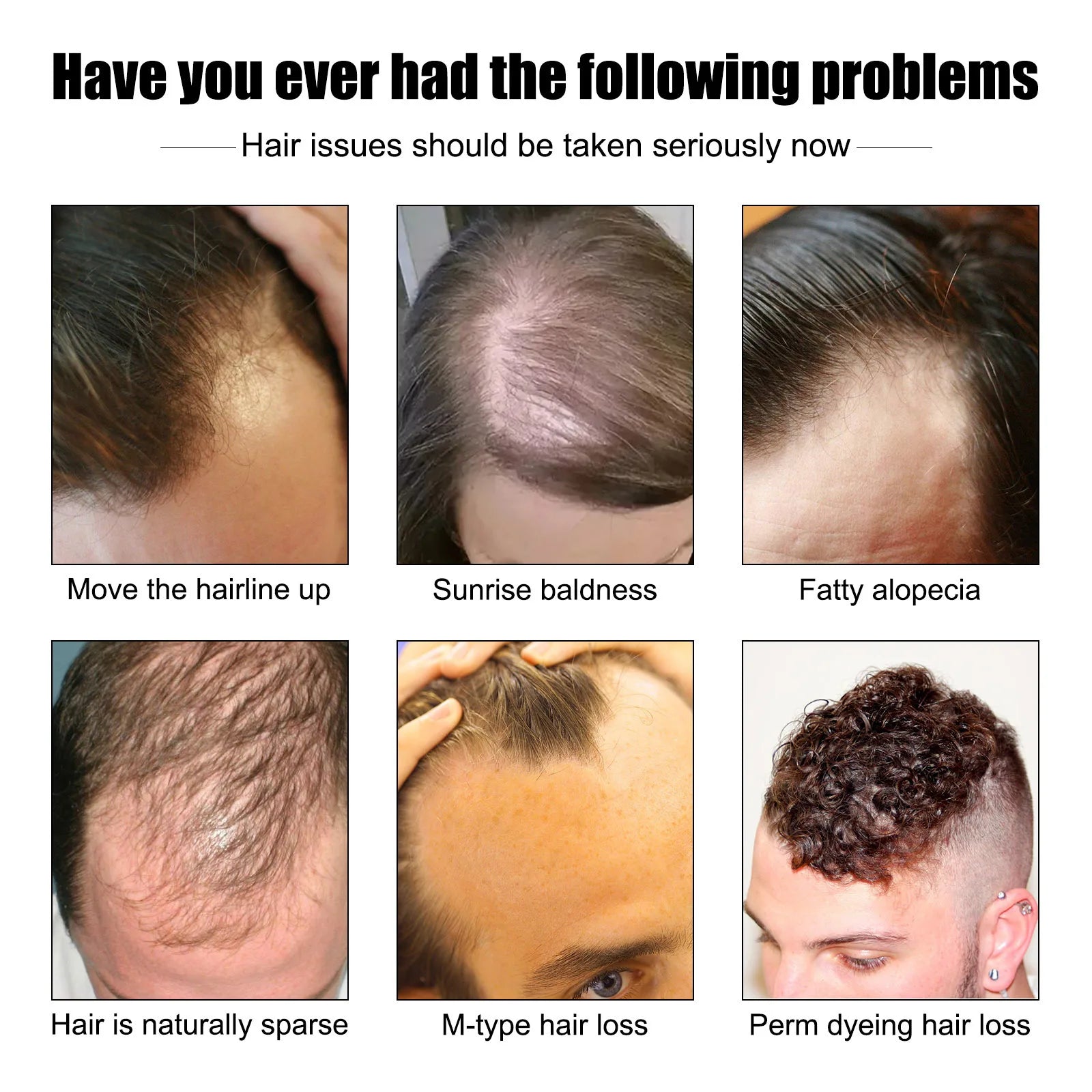East Moon Men's Hair Growth Essence 30ml — Strengthen, Nourish & Prevent Hair Loss