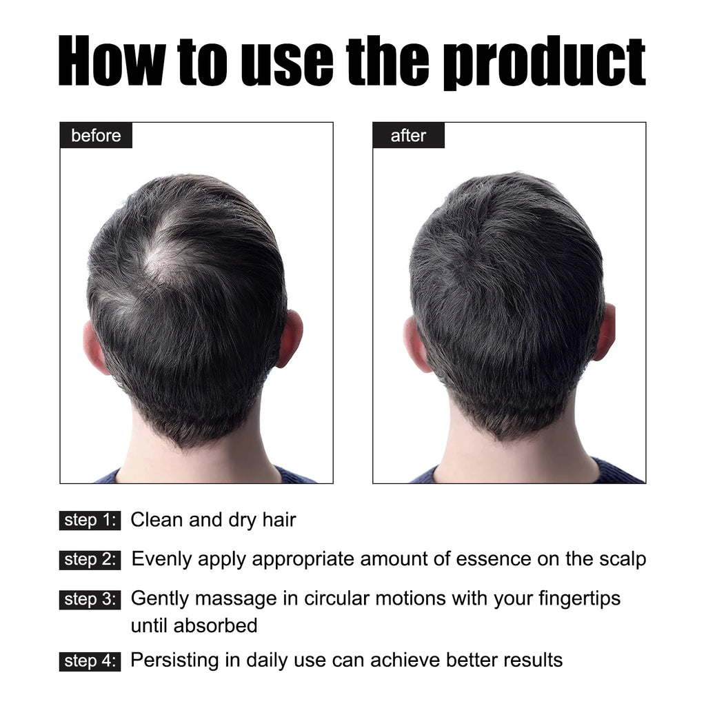 East Moon Men's Hair Growth Essence 30ml — Strengthen, Nourish & Prevent Hair Loss