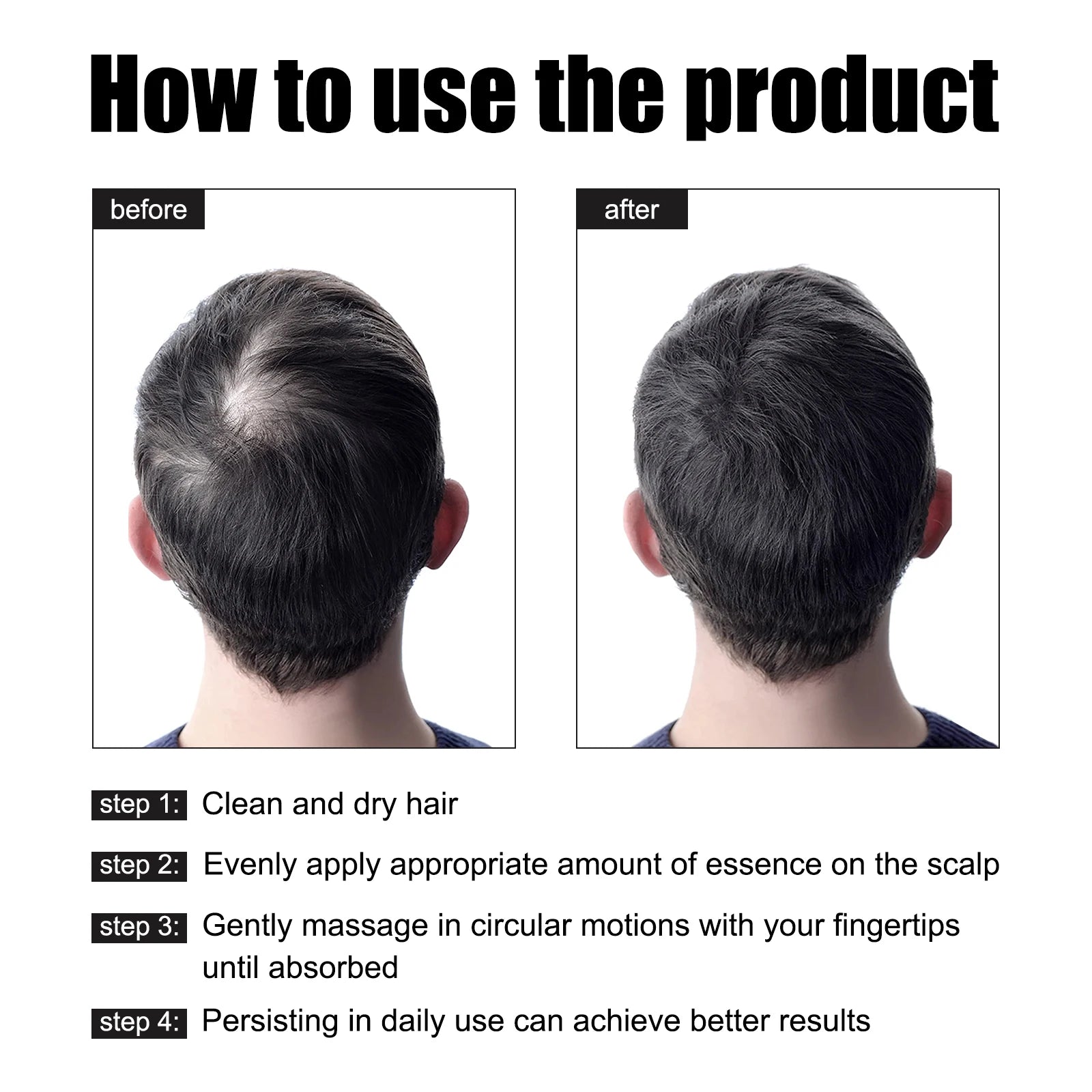 East Moon Men's Hair Growth Essence 30ml — Strengthen, Nourish & Prevent Hair Loss