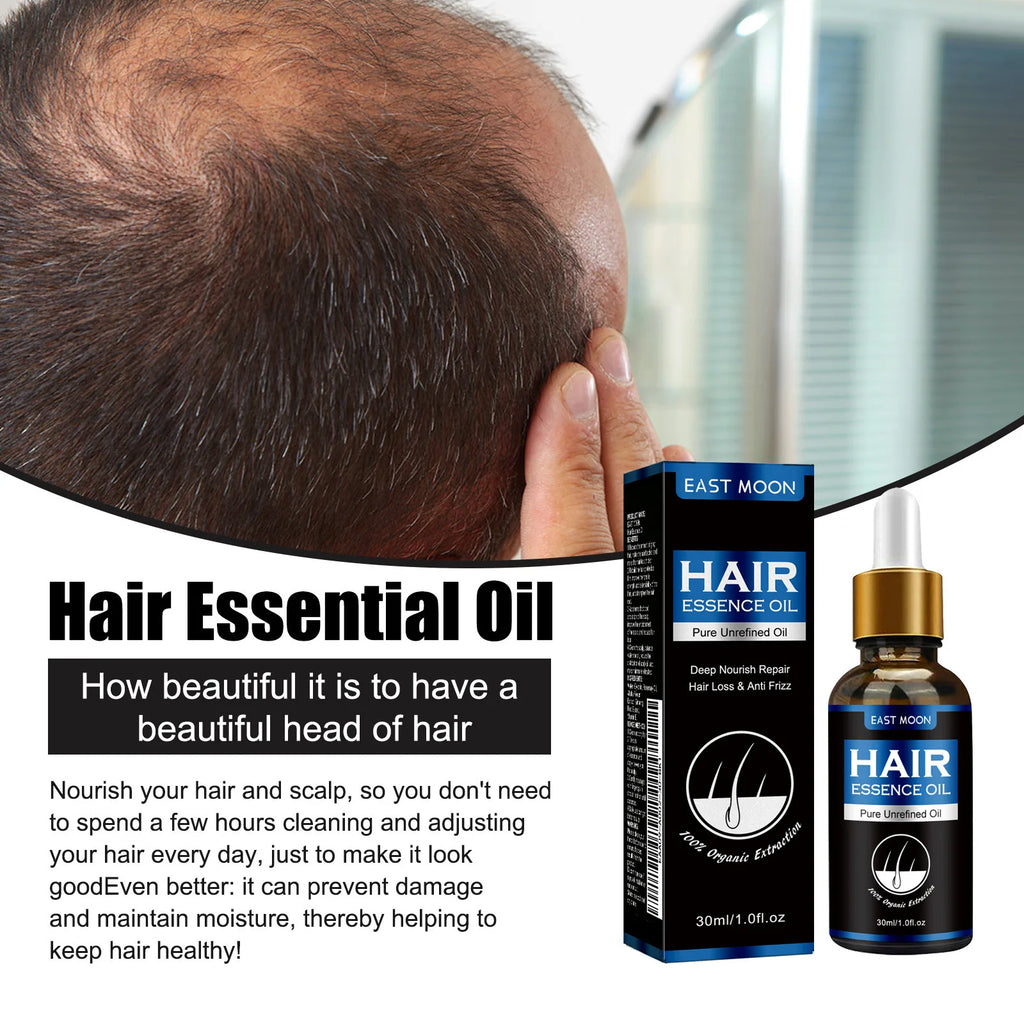 East Moon Men's Hair Growth Essence 30ml — Strengthen, Nourish & Prevent Hair Loss