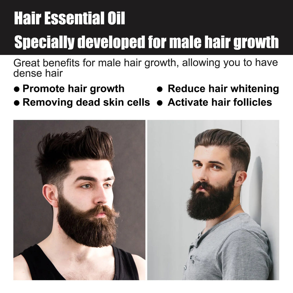 East Moon Men's Hair Growth Essence 30ml — Strengthen, Nourish & Prevent Hair Loss