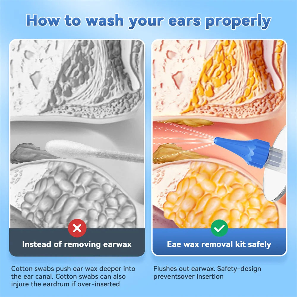 Ear Wax Removal Kit – Manual Ear Irrigation & Flushing System with Basin, 10 Tips & 5-Hole Nozzle