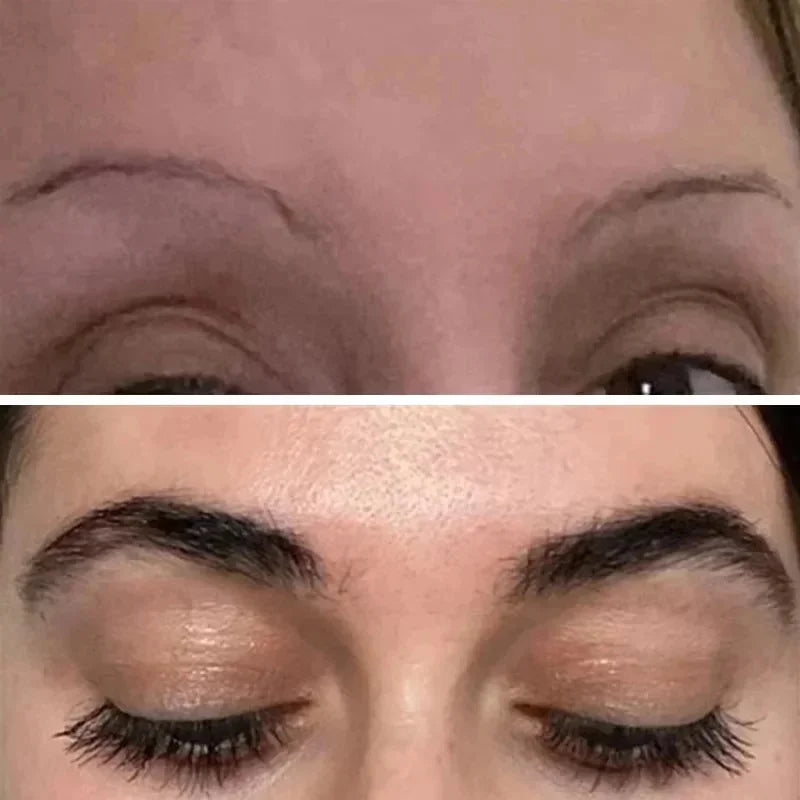 Fast Eyebrow & Eyelash Growth Serum — Anti-Hair Loss