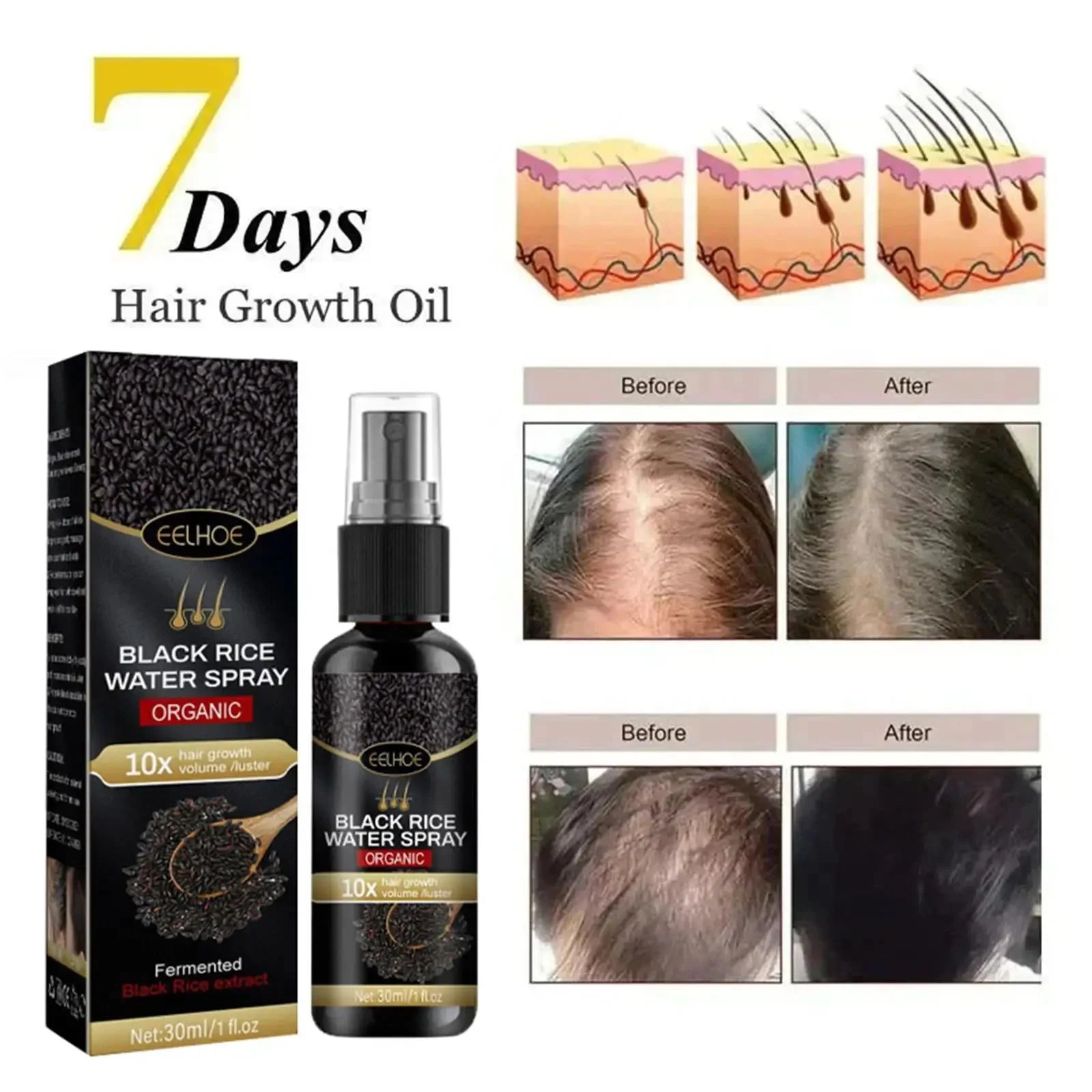 Black Rice Fast Hair Growth Serum Spray for Men Women Anti-loss Hair Regrowth Essential Oil Scalp Treatment Hair Care Products