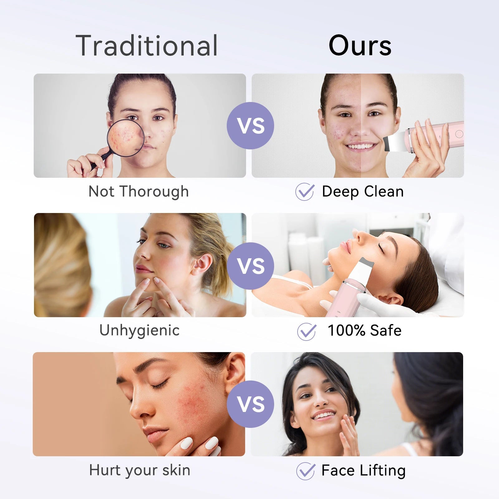 ANLAN Ultrasonic Skin Scrubber – 4-Mode Facial Pore Cleansing Spatula with Microcurrent Lifting