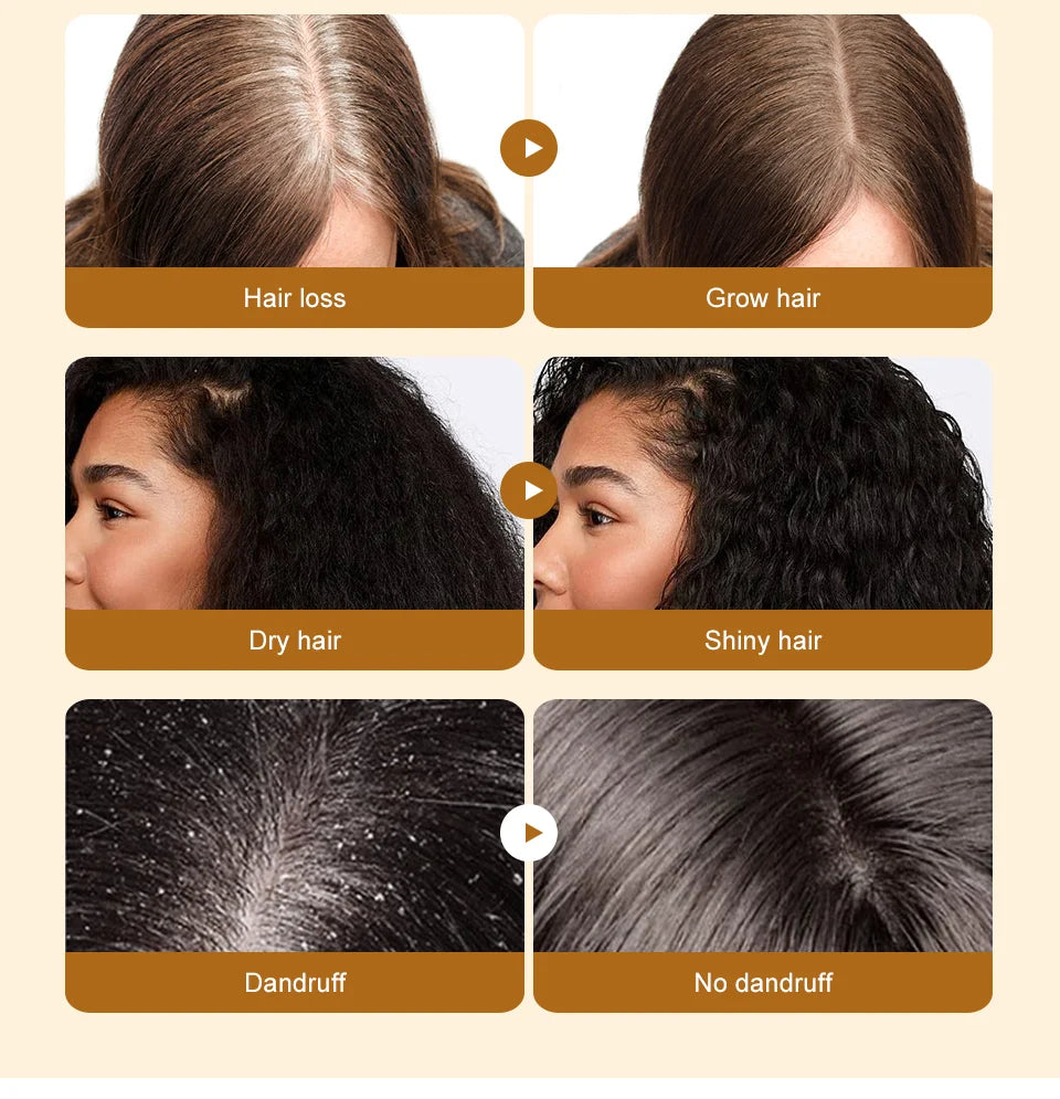 Batana Oil Hair Growth Serum — Anti-Hair Loss Essence for Thicker, Stronger Hair