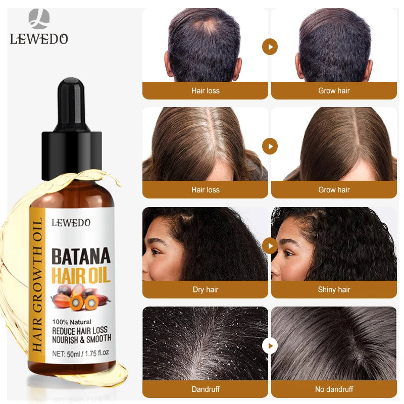 Batana Oil Hair Growth Serum — Anti-Hair Loss Essence for Thicker, Stronger Hair