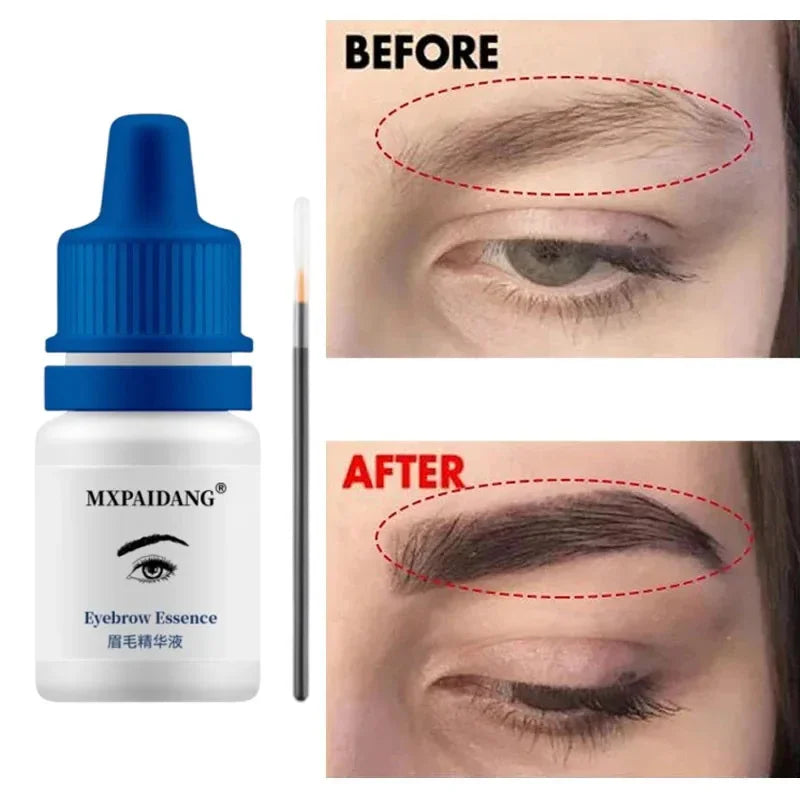 Fast Eyebrow & Eyelash Growth Serum — Anti-Hair Loss
