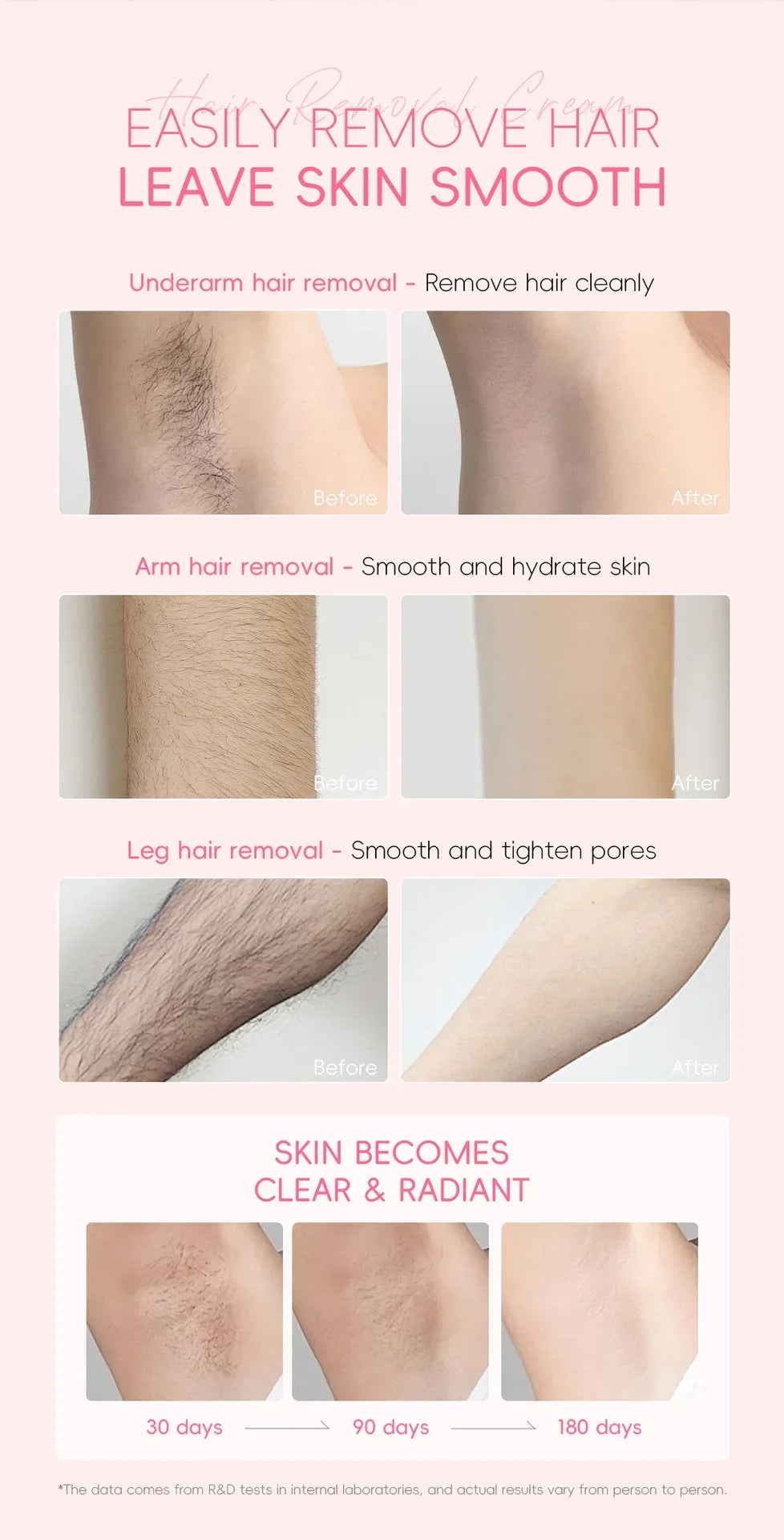 LAIKOU Hair Removal Cream For Men Women Body Intimate Areas Skin Care Moisturizing 50g