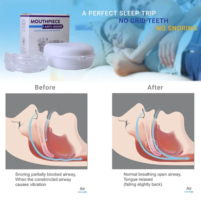 Anti-Snoring Mouth Guard — Teeth Grinding & Sleep Apnea Relief Device