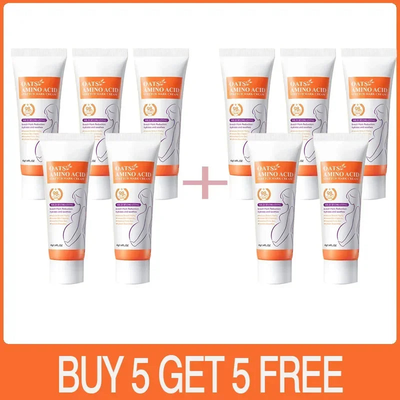 Stretch Marks Permanent Removal Cream — Repair, Firming & Skin Elasticity Body Cream 40g