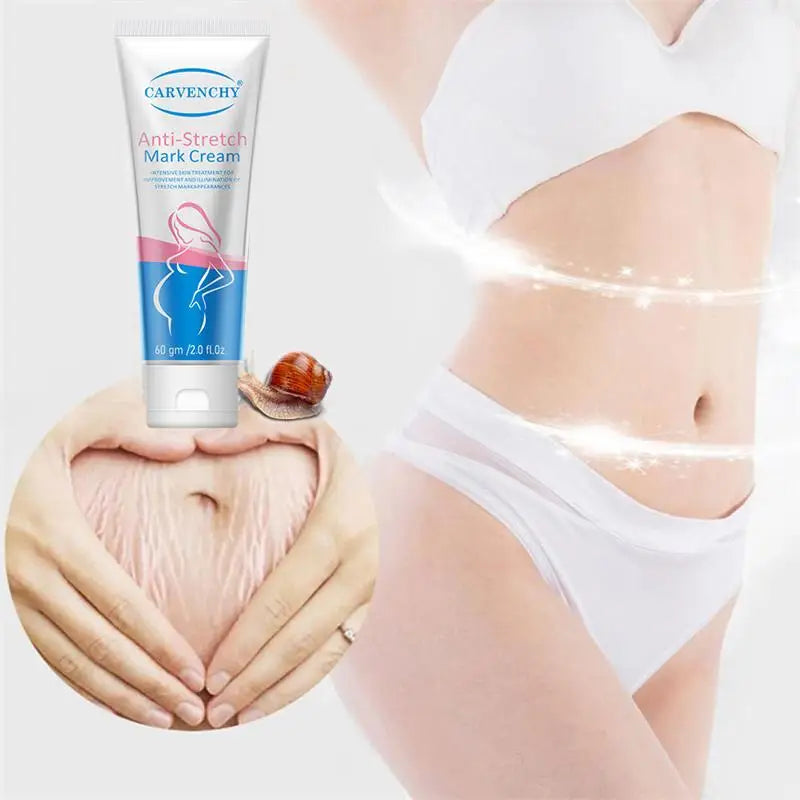 Snail Removes Stretch Mark Cream — Postpartum Firming, Anti-Aging & Wrinkle Repair Body Cream 60g
