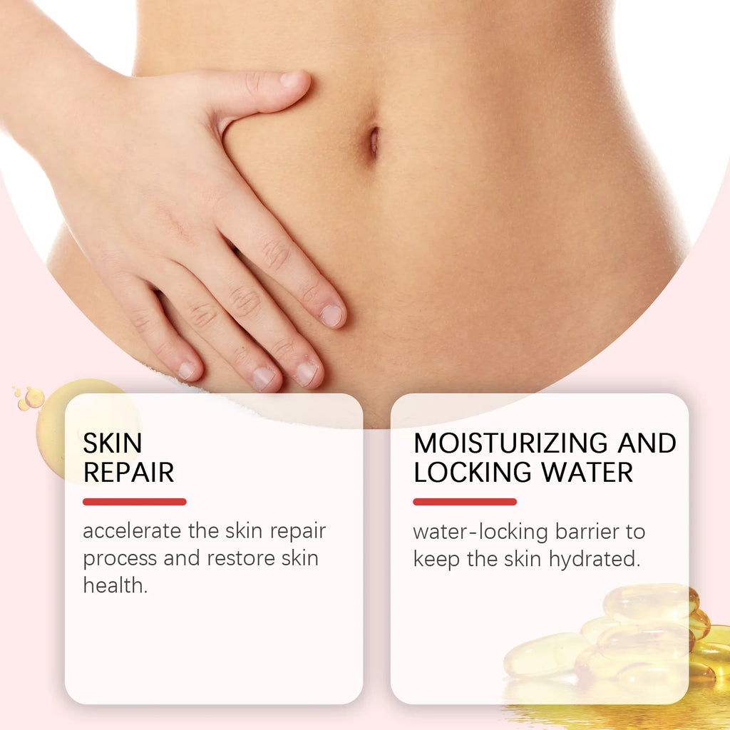 OUHOE Stretch Mark Removal Cream — Postpartum Firming, Anti-Fine Lines & Maternity Body Lotion 80g