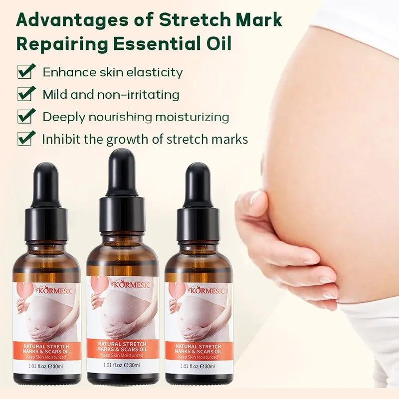 Stretch Marks Remover Essential Oil — Pregnancy & Maternity Stretch Mark Removal Serum, Skin Elasticity