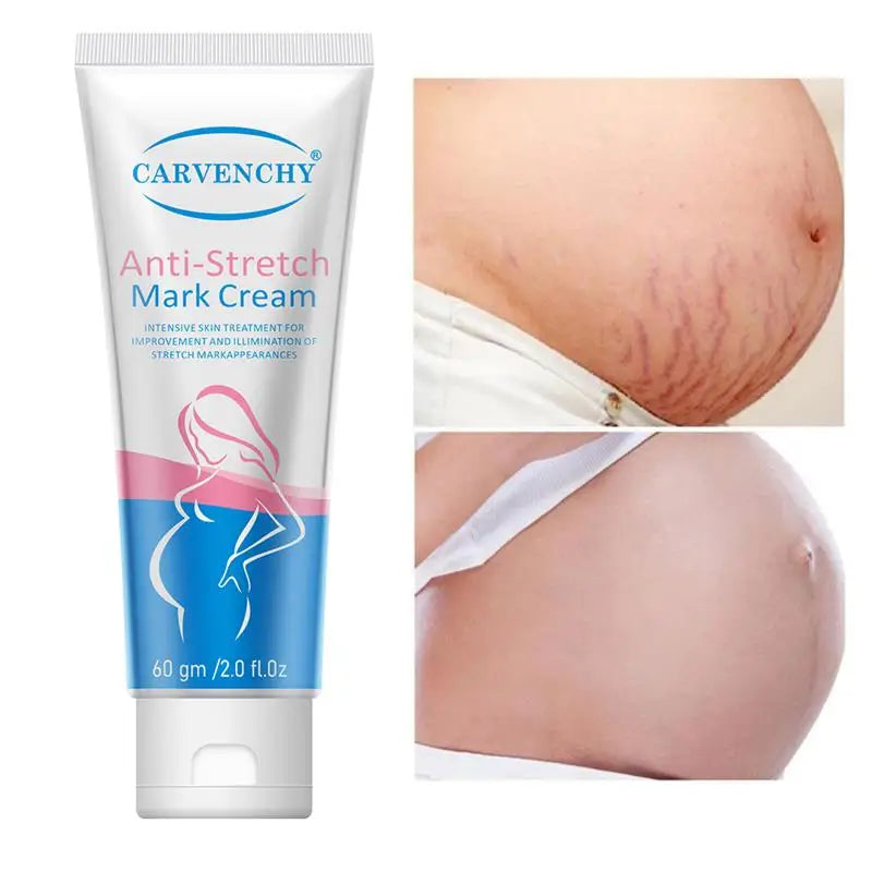 Snail Removes Stretch Mark Cream — Postpartum Firming, Anti-Aging & Wrinkle Repair Body Cream 60g