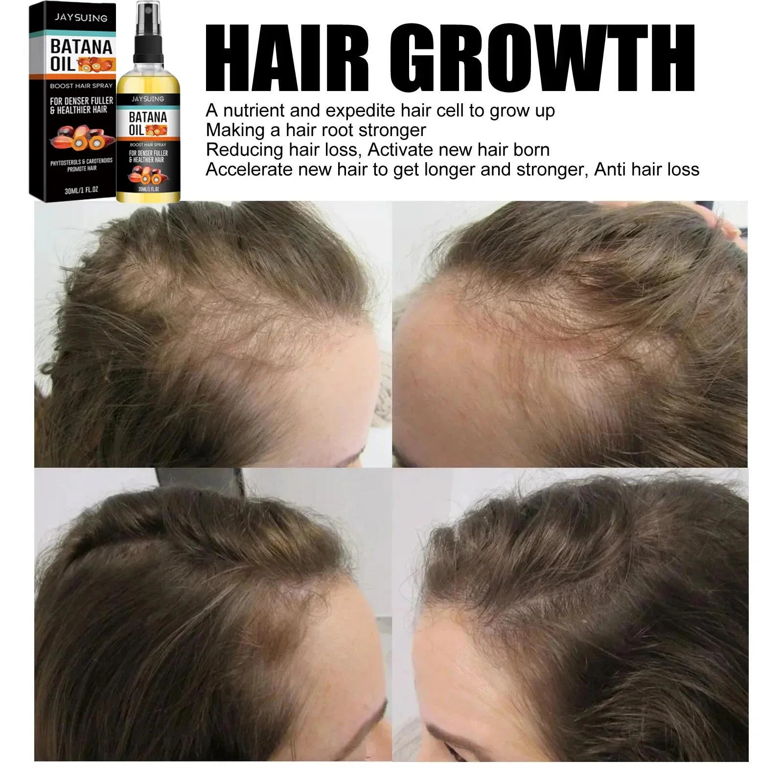 Batana Oil Hair Growth Serum Spray Repair Hair Nourish Root Regrowth Hair Anti Hair Loss Essence Men Women Hair Care Products