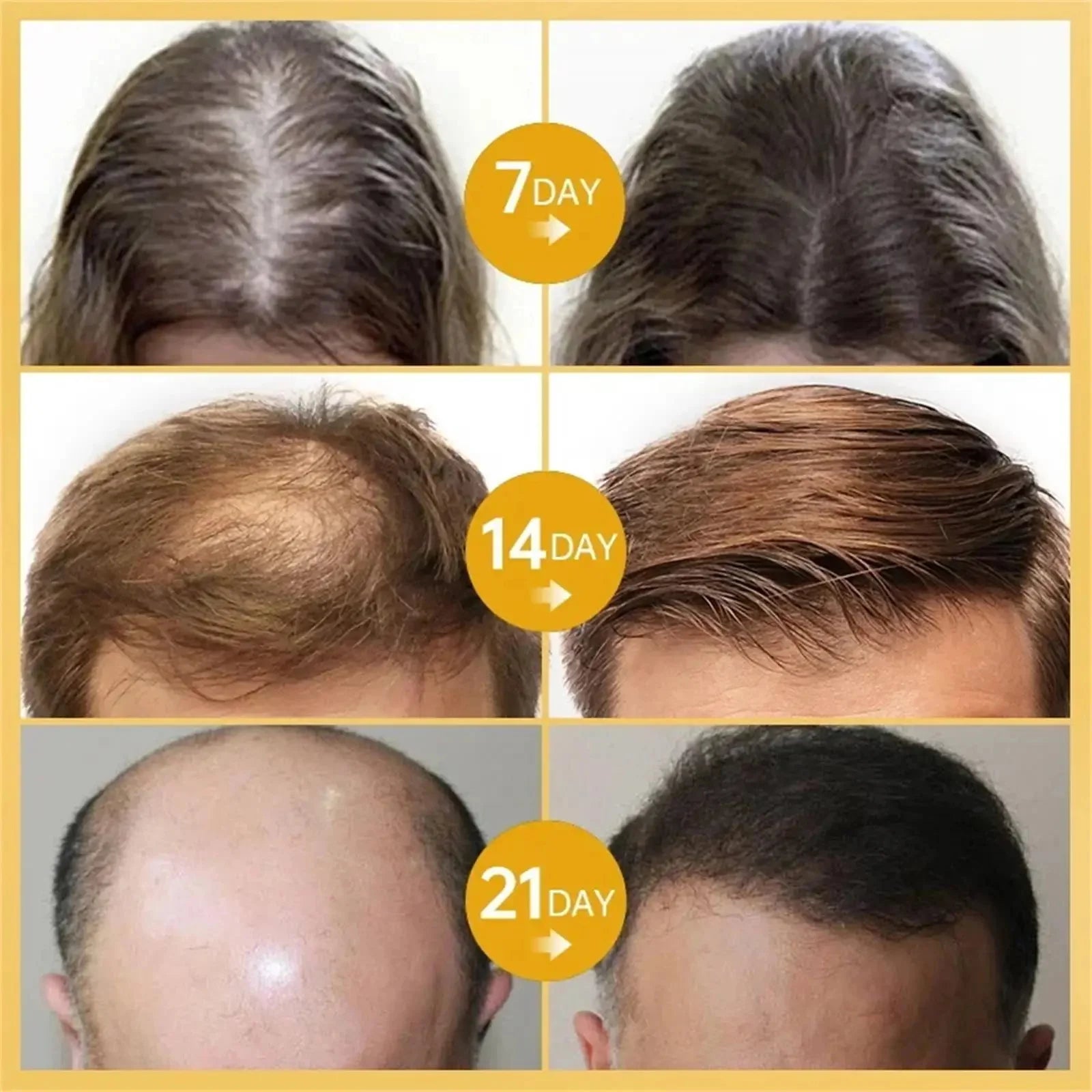 Black Rice Fast Hair Growth Serum Spray for Men Women Anti-loss Hair Regrowth Essential Oil Scalp Treatment Hair Care Products