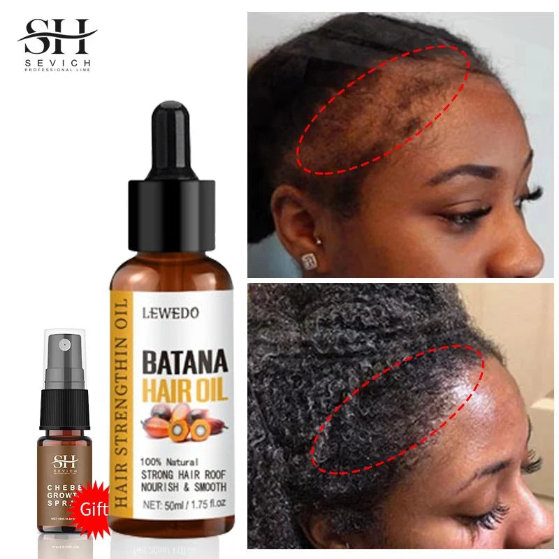 Batana Oil Hair Growth Serum — Anti-Hair Loss Essence for Thicker, Stronger Hair