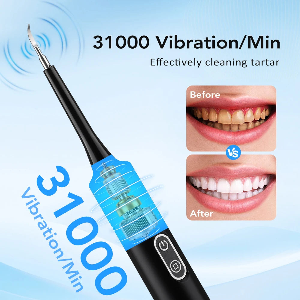 Dentist-Level Clean at Home — Electric Teeth Cleaner & Tartar Remover | 6-Gear Modes, 31,000 Vibrations/Min, IPX6 Waterproof, Type-C Charging