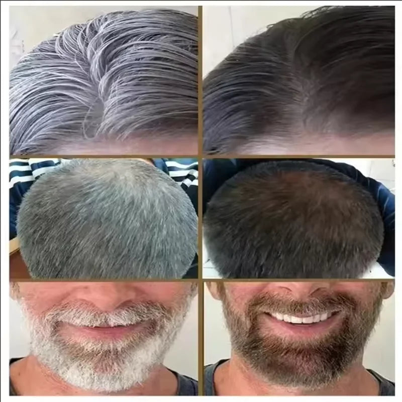 Herbal Anti-grey Hair Treatment Serum Cream White To Black Permanent Repair Natural Color Nourish Scalp Hair Care Products