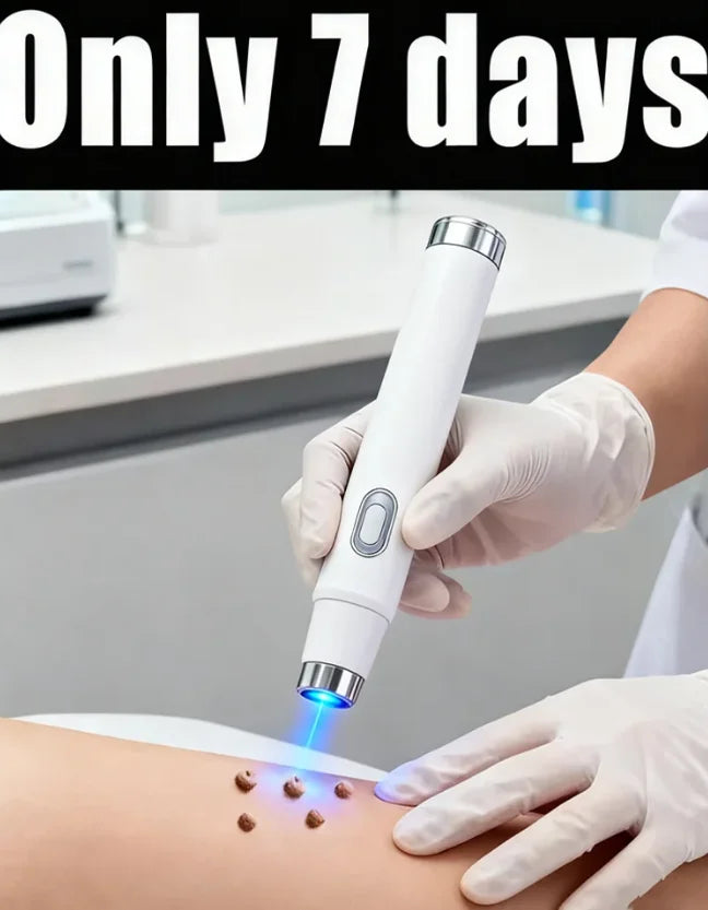 Blue Light Wart & Skin Care Tool — Easy-to-Use Portable Skin Treatment Device