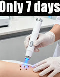 Blue Light Wart & Skin Care Tool — Easy-to-Use Portable Skin Treatment Device