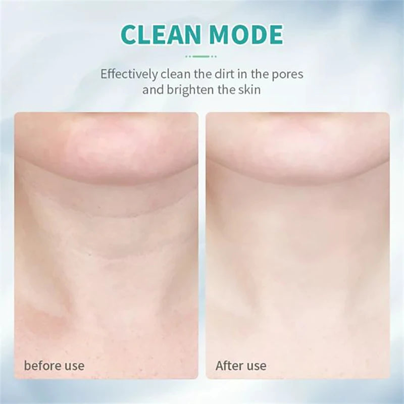7-Color EMS Neck & Face Lifting Massager – LED Photon Therapy, Skin Tightening & Double Chin Remover