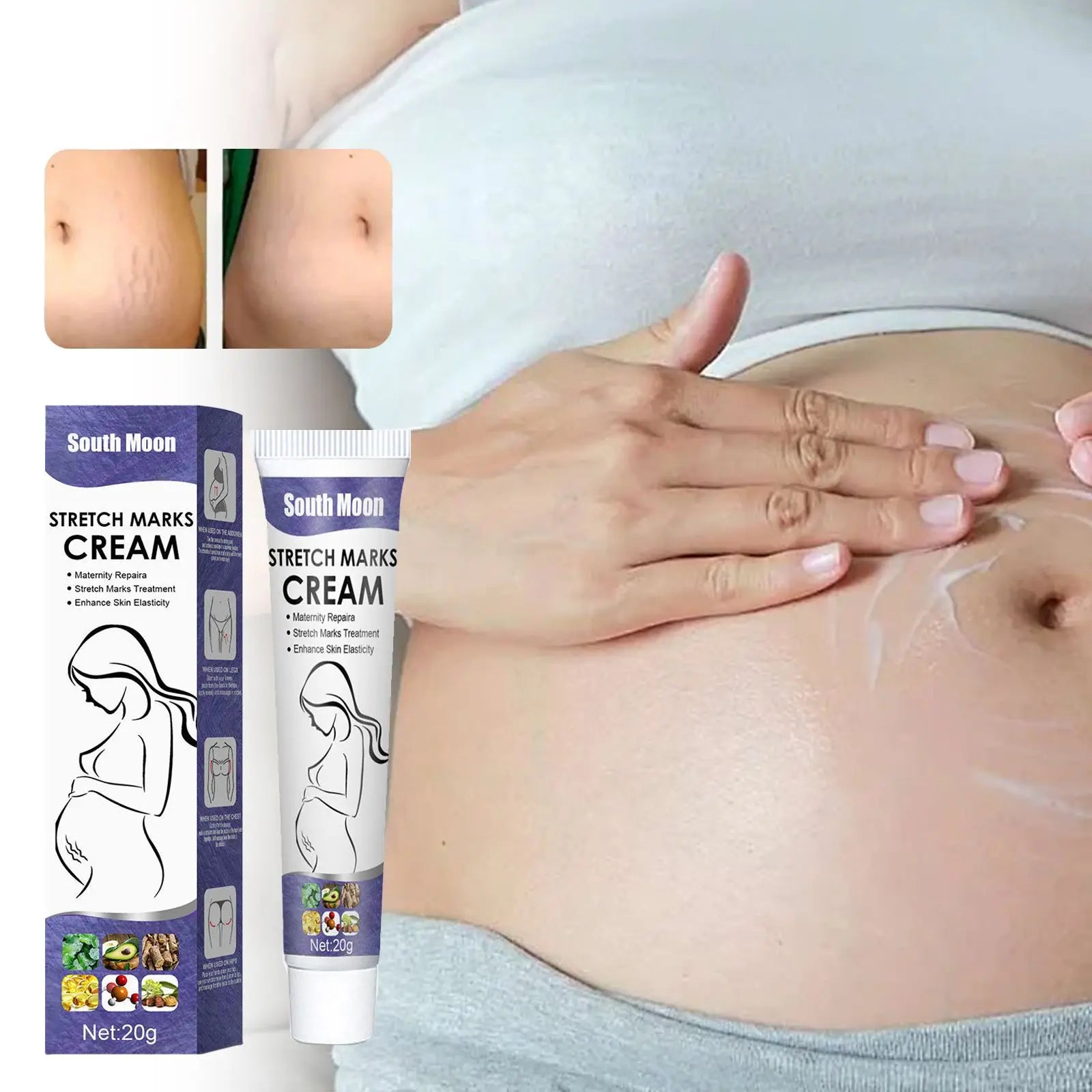 Stretch Marks Permanent Removal Cream — Maternity Repair, Anti-Wrinkle & Firming Skin Care 20g