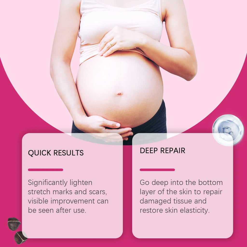 EELHOE Vitamin E Skin Care Oil — Pregnancy Stretch Mark Removal & Firming Collagen Body Oil 100ml