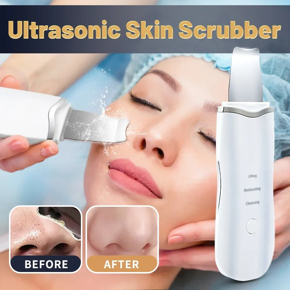 Ion Facial Skin Scrubber – Deep Pore Cleaning, Blackhead Removal & Peeling Device IPX-7 Waterproof