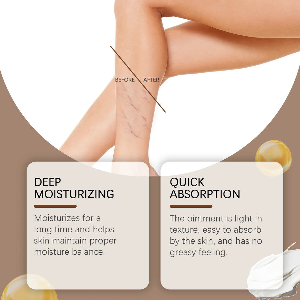 Varicose Veins Relief Cream — Soothing Leg Comfort & Skin Care (60g / 120g / 180g)