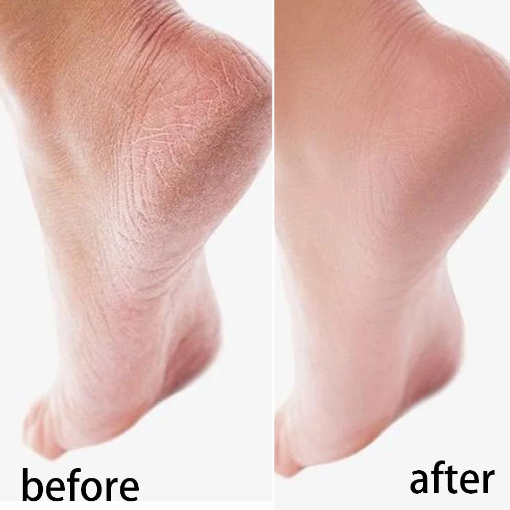 Silicone Moisturizing Hand & Foot Mask Socks – Reusable Exfoliating Gloves