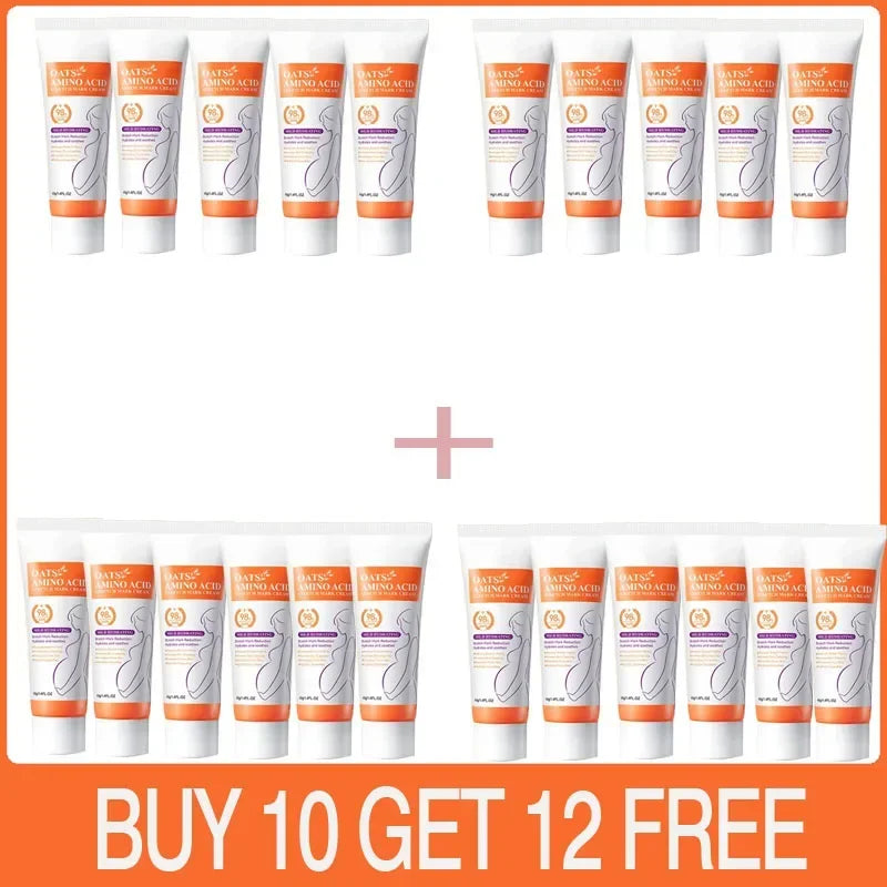 Stretch Marks Permanent Removal Cream — Repair, Firming & Skin Elasticity Body Cream 40g