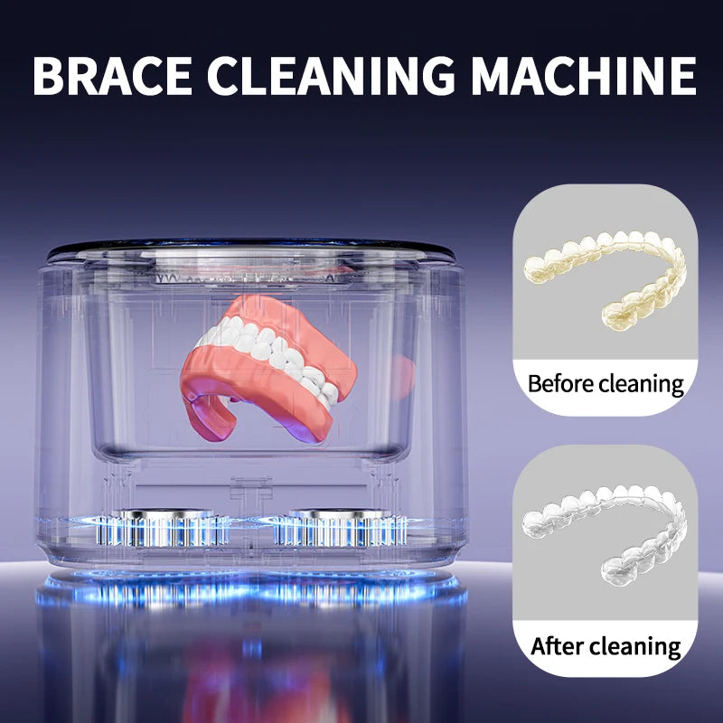 USB Electric Ultrasonic Cleaner – Denture, Retainer & Invisible Braces Cleaning Machine