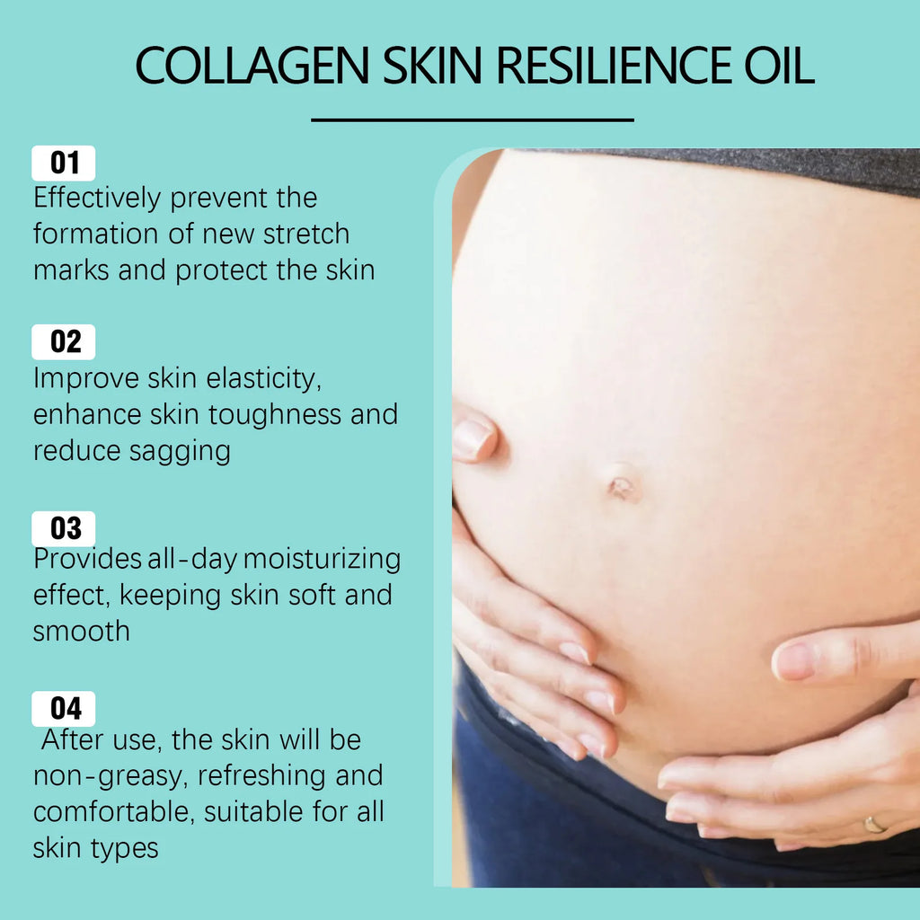 Hoygi Stretch Mark Removal Oil — Anti-Wrinkle, Lifting & Tightening Maternity Scar Repair Oil 32ml