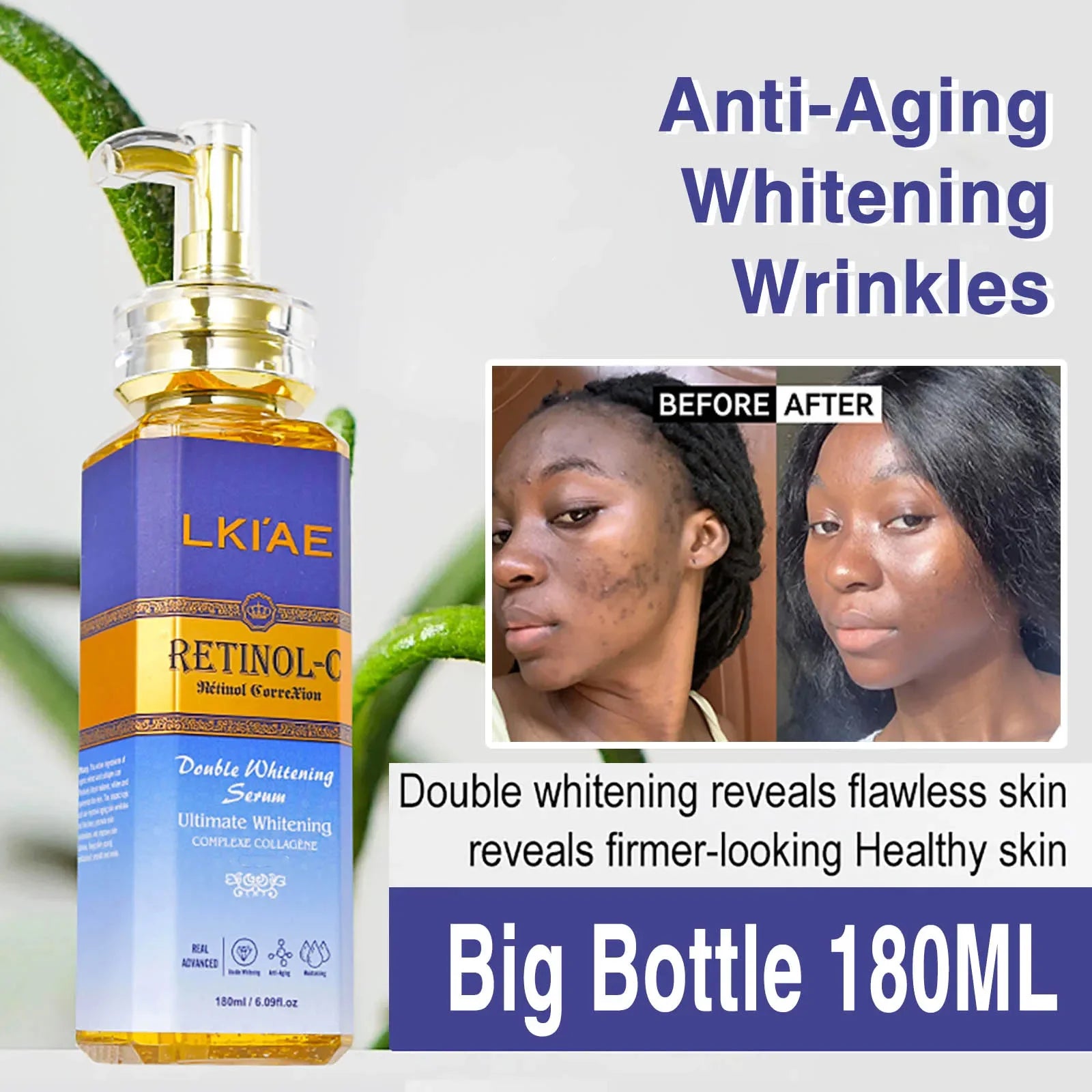 AILKE Retinol Double Whitening 5-in-1 Skincare Kit – Body Lotion, Face Cream, Serum & Cleanser for All Skin Types