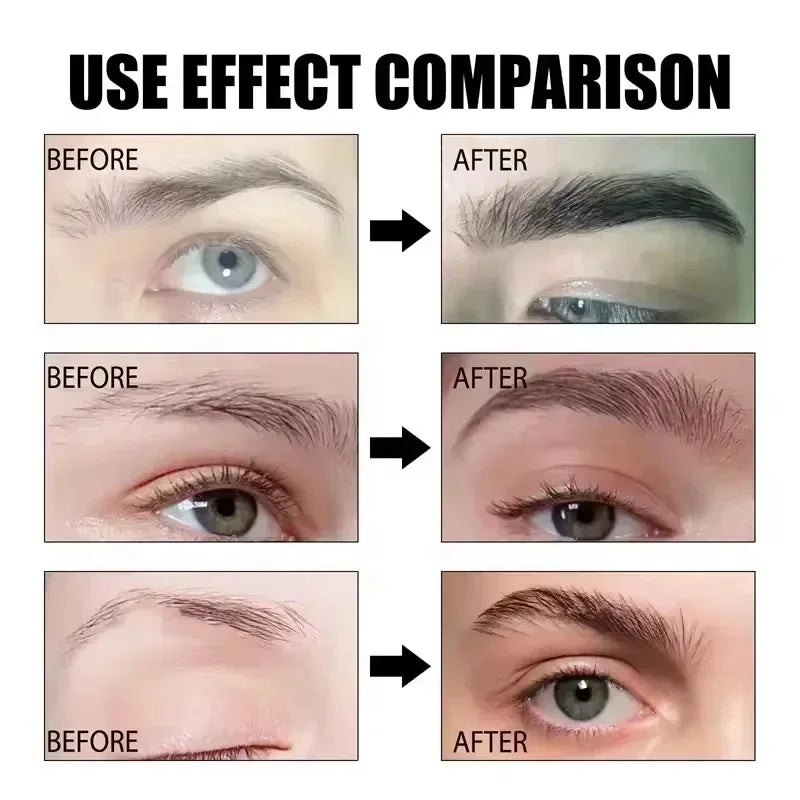 Fast Eyebrow & Eyelash Growth Serum — Anti-Hair Loss