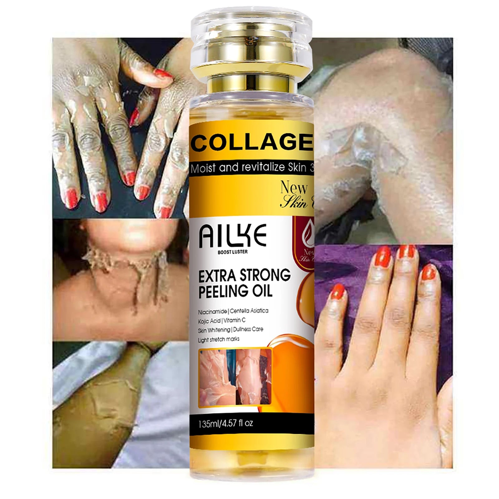 AILKE Collagen Yellow Peeling Oil — Stretch Mark Removal, Brightening & Gentle Exfoliation 135ml