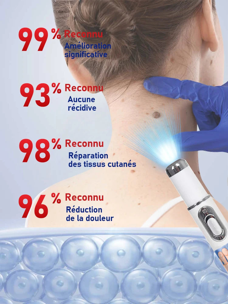 Blue Light Wart & Skin Care Tool — Easy-to-Use Portable Skin Treatment Device