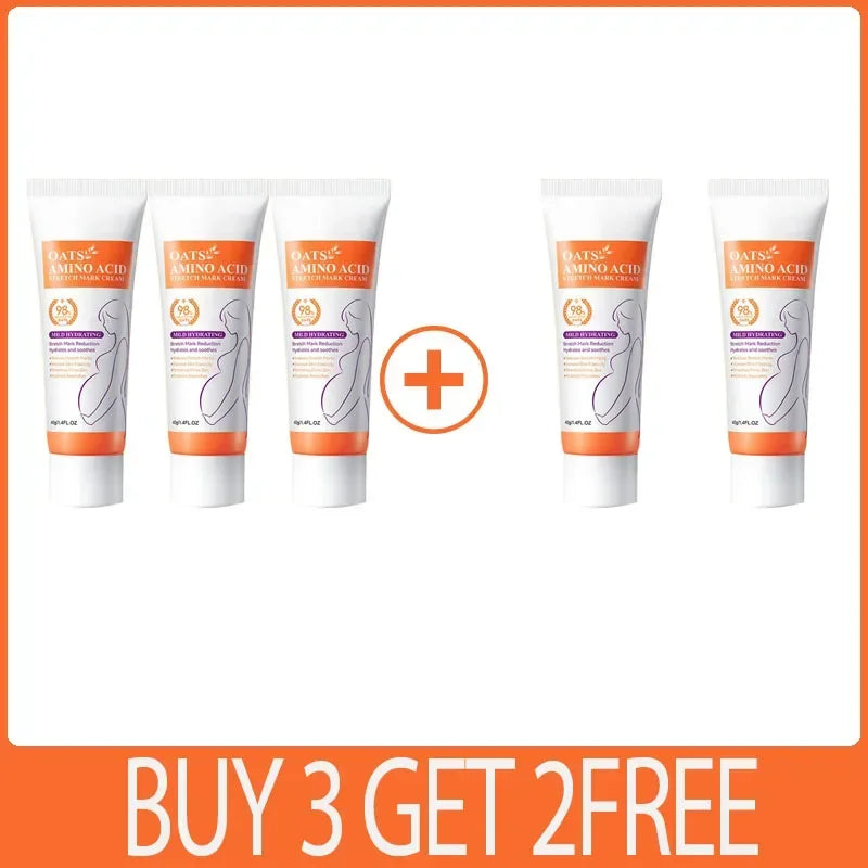 Stretch Marks Permanent Removal Cream — Repair, Firming & Skin Elasticity Body Cream 40g