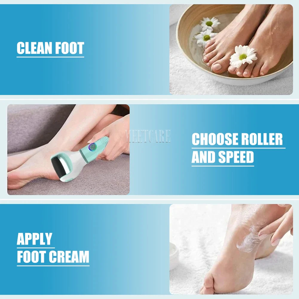 Electric Foot Grinder & Callus Remover – Dead Skin Scrubber for Cracked Heels