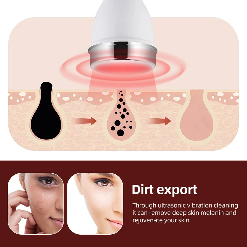 1MHz Ultrasonic Facial Beauty Machine – Lifting, Anti-Aging, Skin Tightening & Eye Care SPA Device