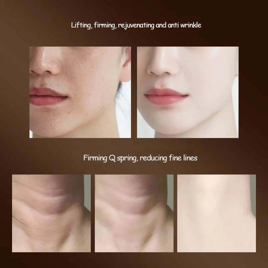 CAMMUO Microcurrent Neck & Face Lifting Massager – Sonic Vibration Anti-Aging Skin Rejuvenation Device
