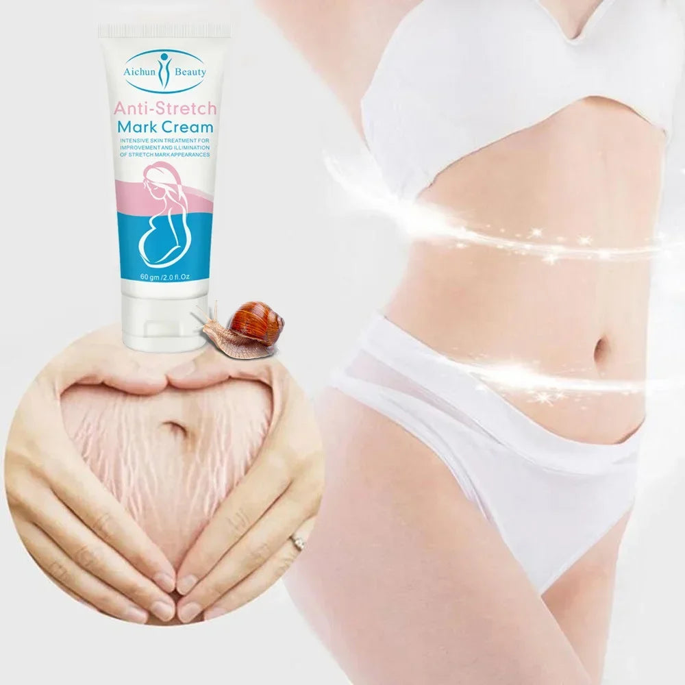 Snail Removes Stretch Mark Cream — Postpartum Repair, Anti-Aging & Firming Body Cream 60g