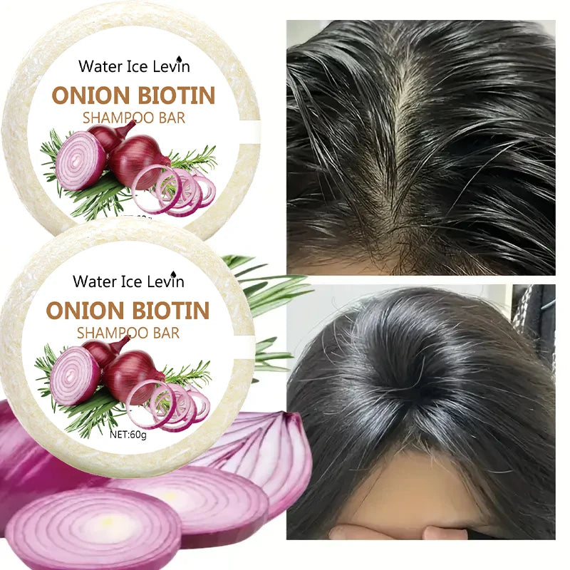 Onion & Biotin Shampoo Bar 60g – Moisturizing, Smoothing & Rosemary Extract for All Hair Types