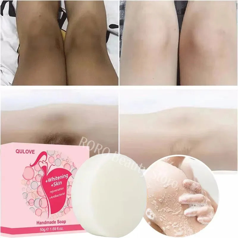 Body Whitening & Brightening Soap Bar – Bleaching Scrub for Knees, Armpits & Intimate Areas