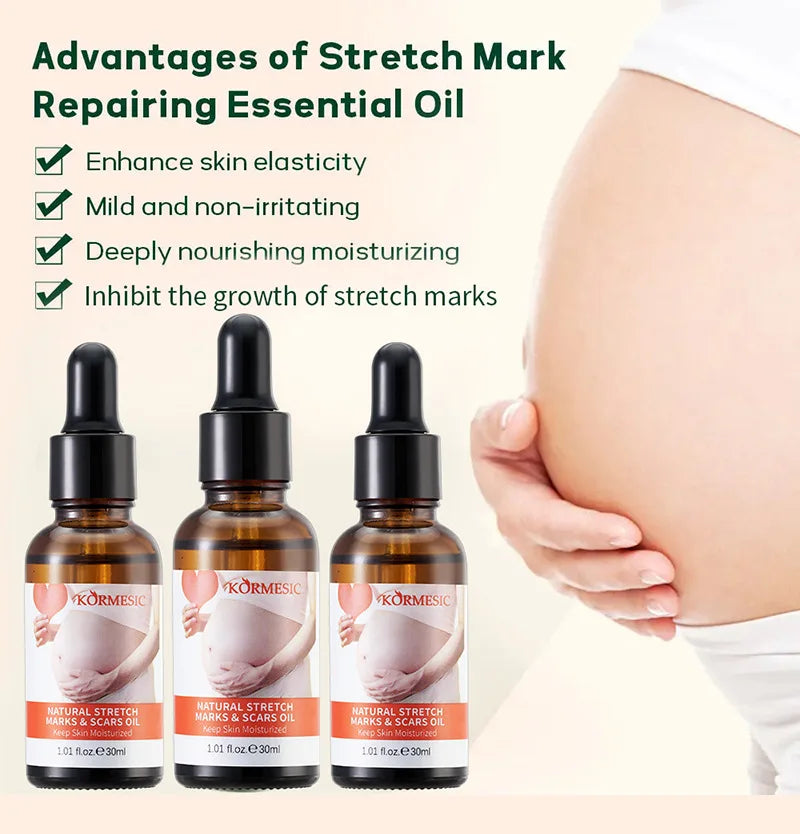 Stretch Marks Remover Essential Oil — Pregnancy & Maternity Stretch Mark Removal Serum, Skin Elasticity