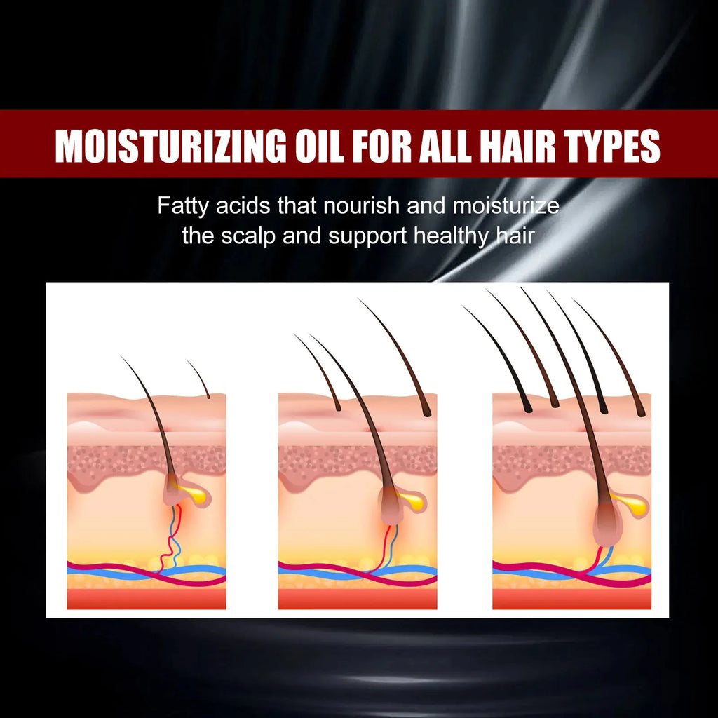 Black Rice Fast Hair Growth Serum Spray for Men Women Anti-loss Hair Regrowth Essential Oil Scalp Treatment Hair Care Products
